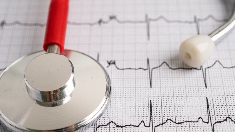 Catheterization Lab Procedures | Springhill Medical Center